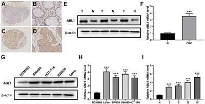 C1222C Deletion in Exon 8 of ABL1 Is Involved in Carcinogenesis and Cell Cycle Control of Colorectal Cancer Through IRS1/PI3K/Akt Pathway